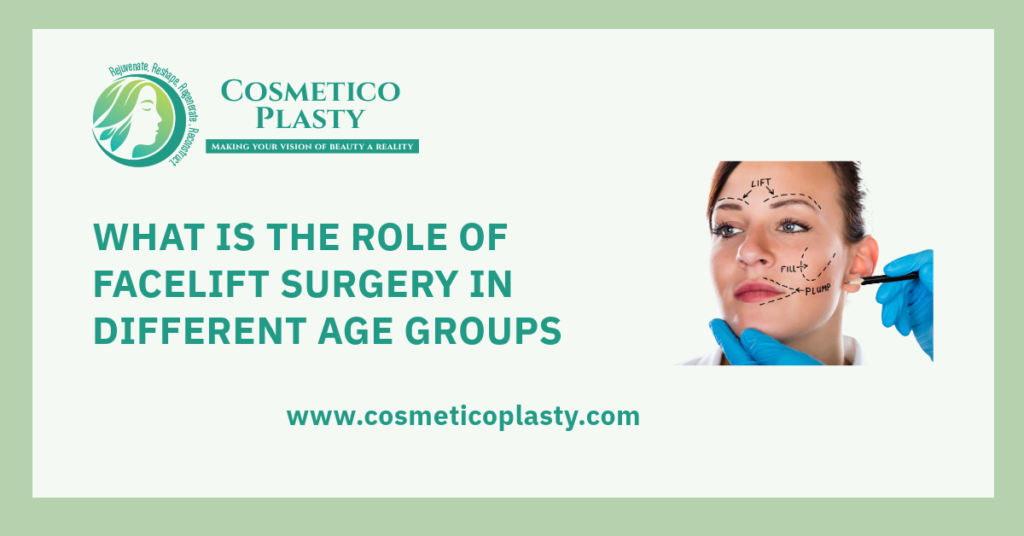 Role of facelift surgery