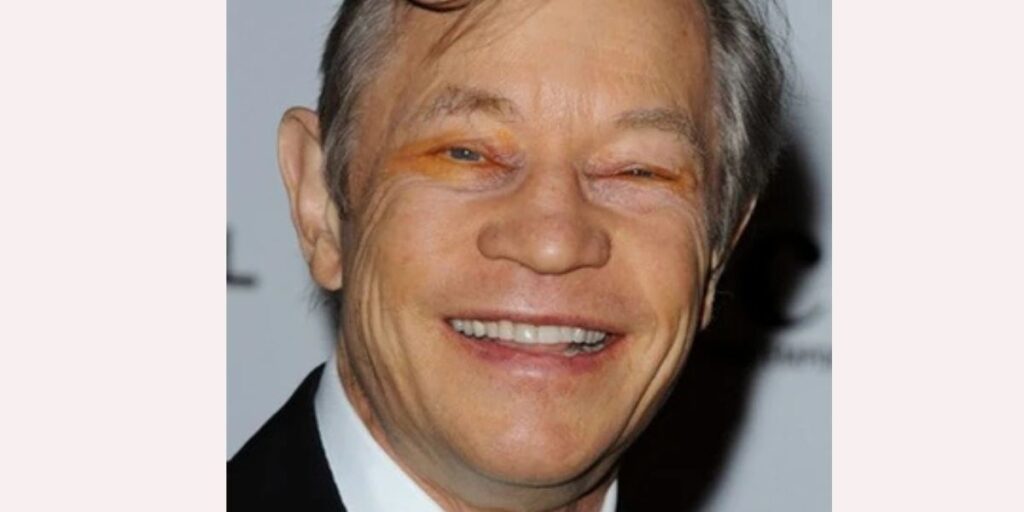 Michael York Eyes