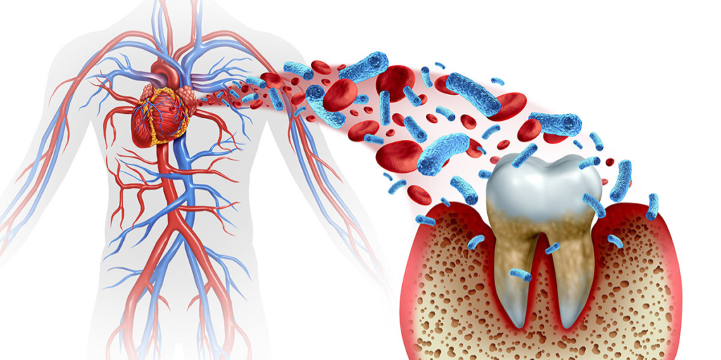 Oral Health Role in Cardiovascular Health