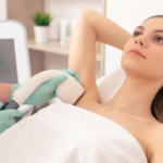 Cosmetic Treatment for Your Hairy Underarms