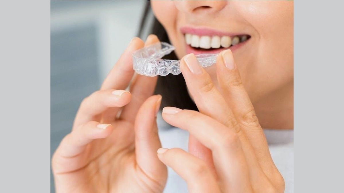 Invisalign Aligners