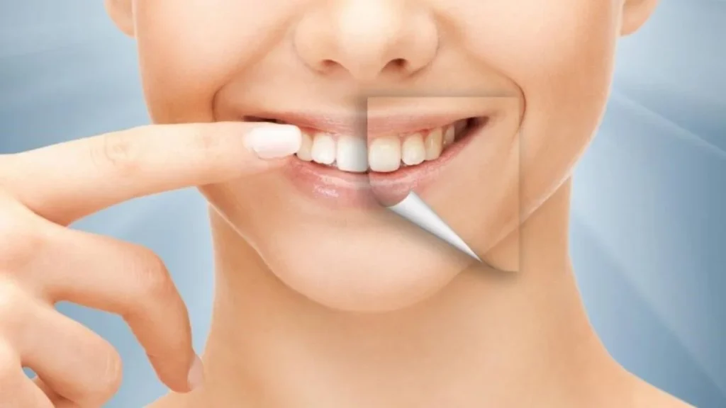 Best Cosmetic Dental Procedure