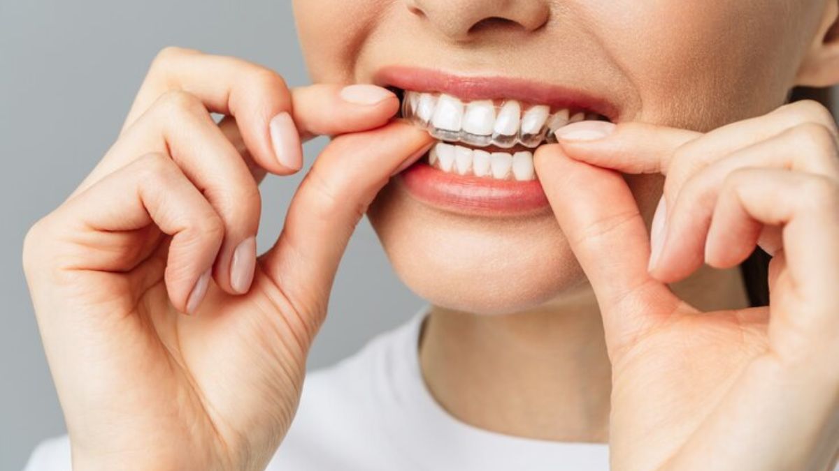Invisalign Near Me