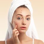 Can Hyaluronic Acid Cause Acne