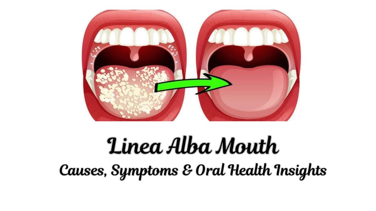 Linea Alba Mouth