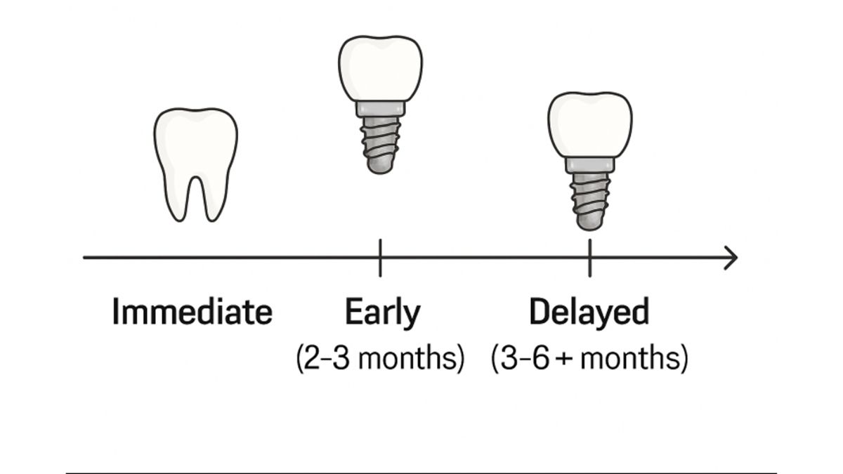 Tooth Extractioneview