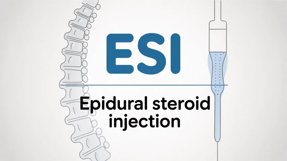 esi medical abbreviation